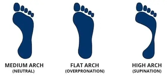 The footprint- overpronation